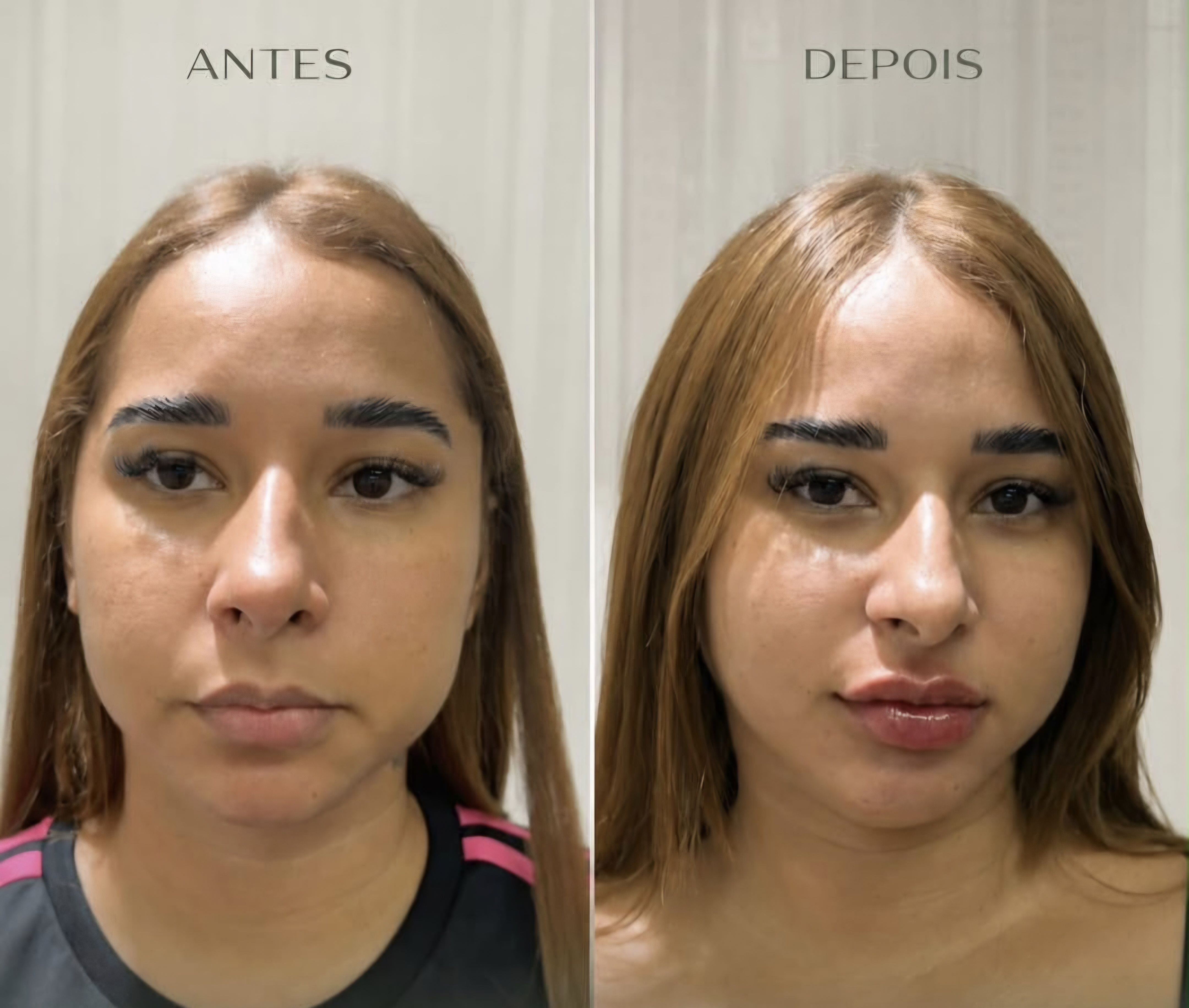 Ambiente e cuidado da Belle's Estética Funcional